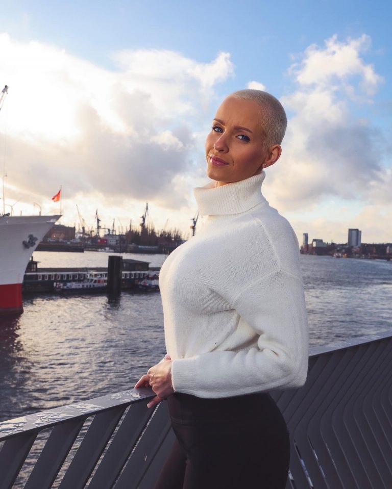 Internetstar Anike Ekina schockiert über Hass-Kommentare aus Deutschland „Was ist nur los mit euch?